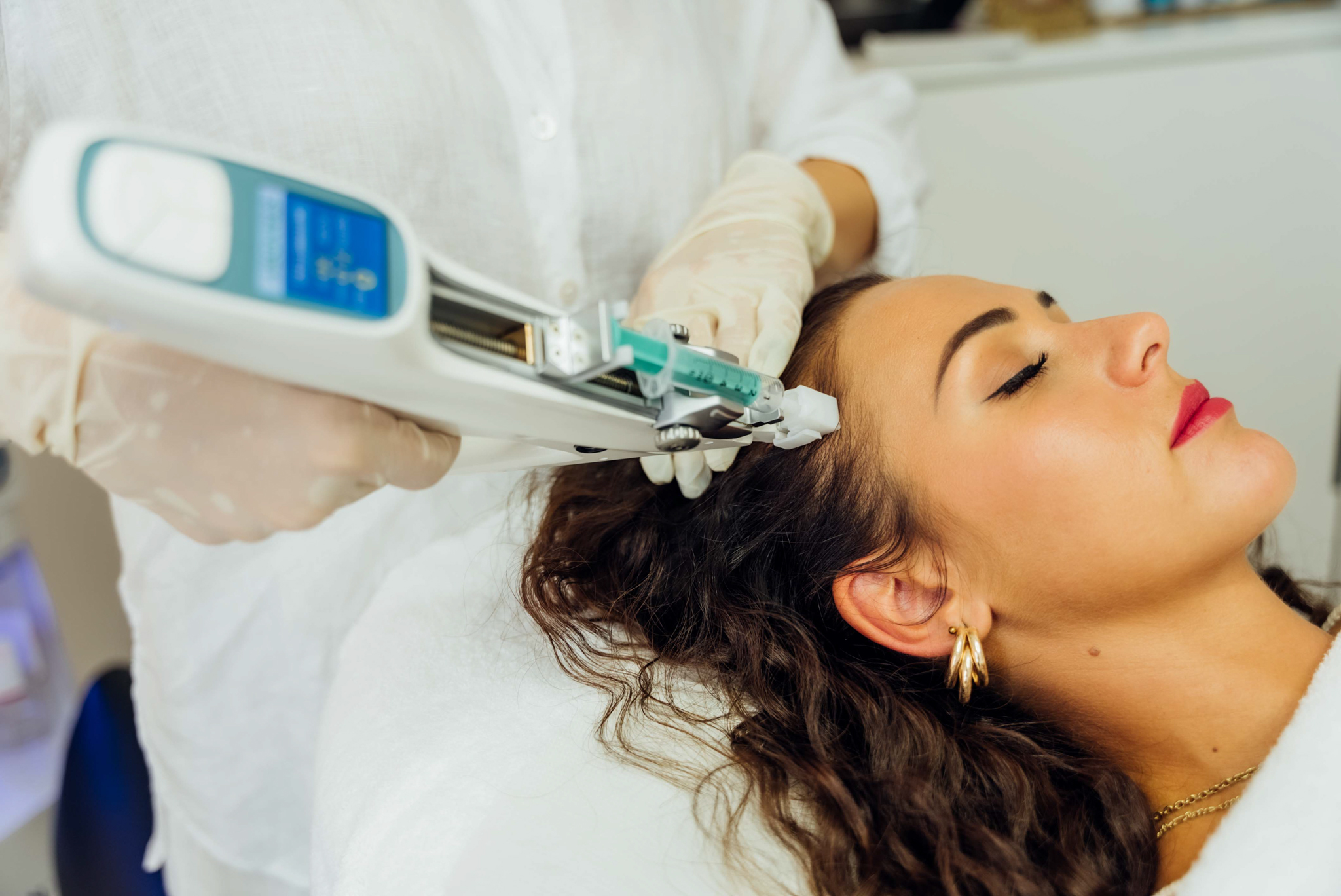 IMG_4239 Mesotherapie gegen Haarausfall