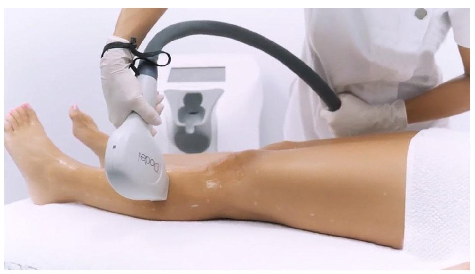 Haarentfernung Preise neu (1)_page-0001