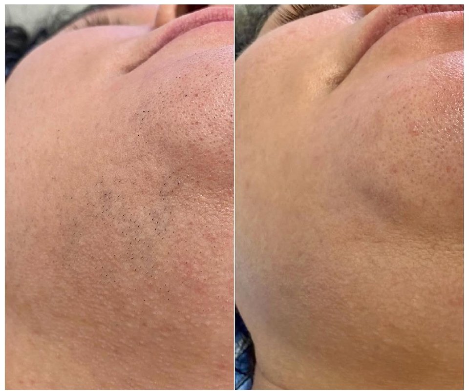 Haarentfernung Preise neu_page-0010