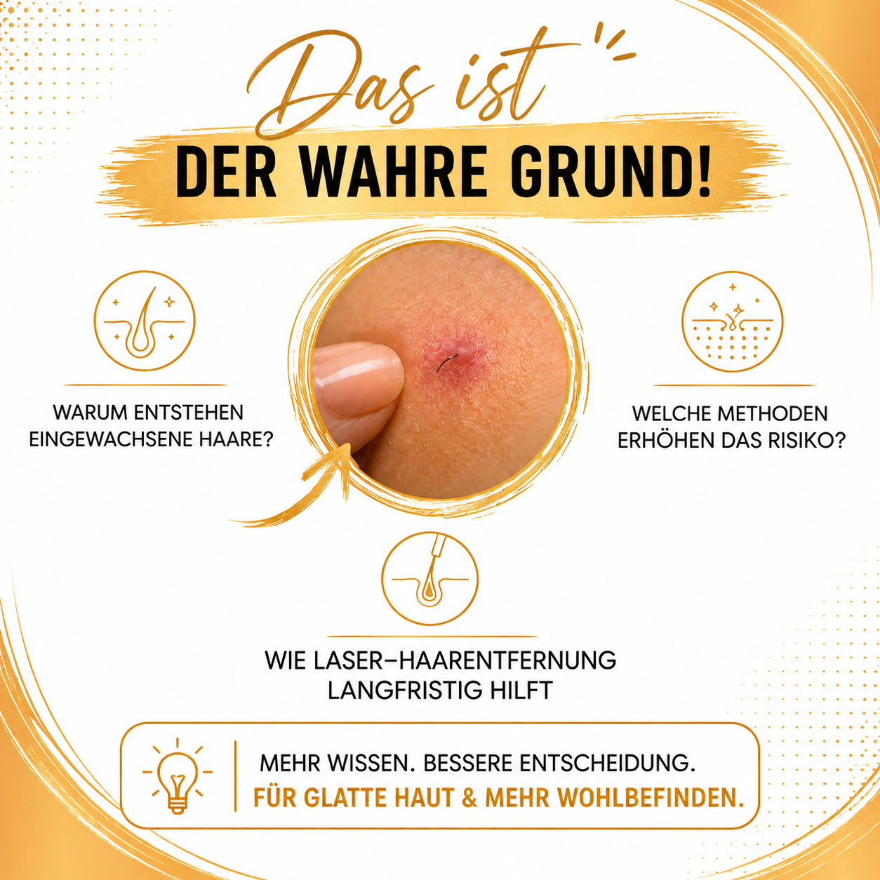 Eingewachsene Haare nach Waxing oder Sugaring? Das ist der wahre Grund!