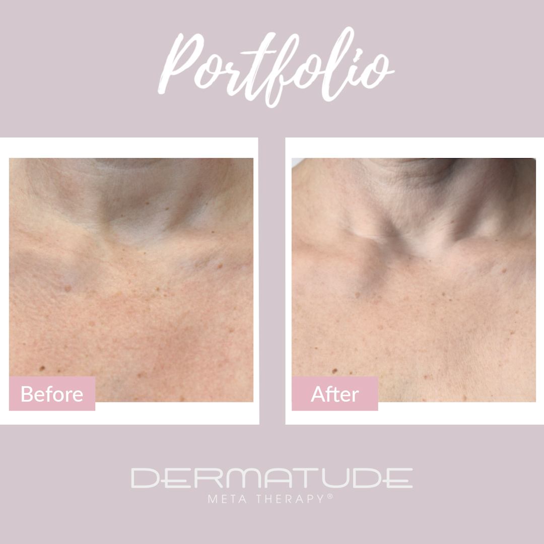 W42 – Before & After
